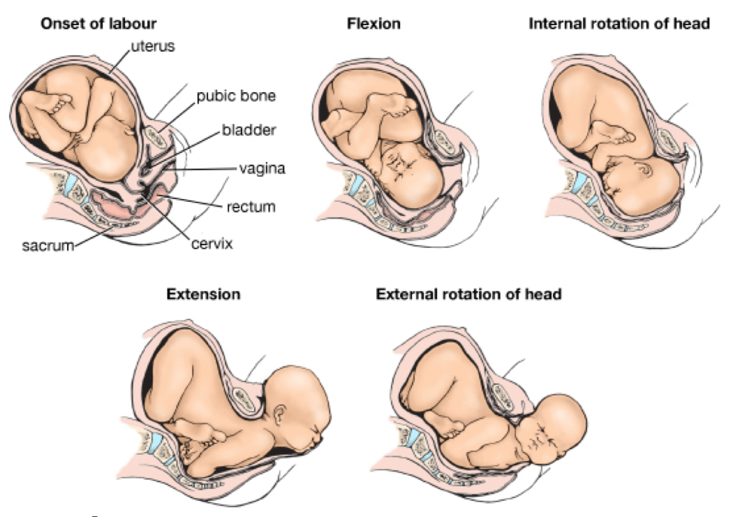 foot presentation in labour